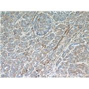 ANXA3 Rabbit Polyclonal Antibody (11804-1-AP)