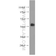 EIF2B4 Rabbit Polyclonal Antibody (11332-1-AP)