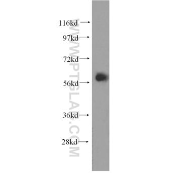 EIF2B4 Rabbit Polyclonal Antibody (11332-1-AP)