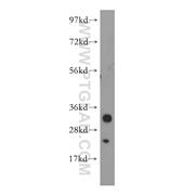MPZL2 Rabbit Polyclonal Antibody (11787-1-AP)