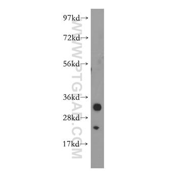 MPZL2 Rabbit Polyclonal Antibody (11787-1-AP)