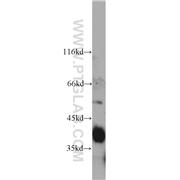 ASGR1 Rabbit Polyclonal Antibody (11739-1-AP)