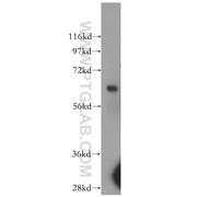 ARSD Rabbit Polyclonal Antibody (11805-1-AP)