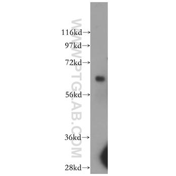 ARSD Rabbit Polyclonal Antibody (11805-1-AP)