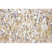 UBE2E2 Rabbit Polyclonal Antibody (11844-1-AP)