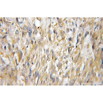 UBE2E2 Rabbit Polyclonal Antibody (11844-1-AP)