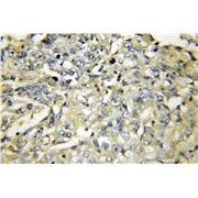 VAMP5 Rabbit Polyclonal Antibody (11822-1-AP)
