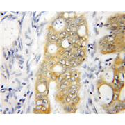 NOLC1 Rabbit Polyclonal Antibody (11815-1-AP)