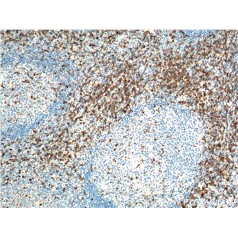 CD7 Rabbit Polyclonal Antibody (11320-1-AP)