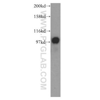 TPX2 Rabbit Polyclonal Antibody (11741-1-AP)