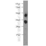 FCN3 Rabbit Polyclonal Antibody (11867-1-AP)