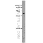 ZNF395 Rabbit Polyclonal Antibody (11759-1-AP)