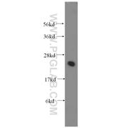 UBE2K Rabbit Polyclonal Antibody (11834-3-AP)