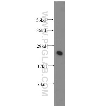 UBE2K Rabbit Polyclonal Antibody (11834-3-AP)
