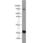 TWIST2 Rabbit Polyclonal Antibody (11752-1-AP)