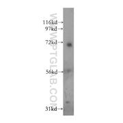 PSG1 Rabbit Polyclonal Antibody (11809-1-AP)