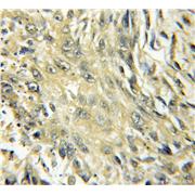CYP4B1 Rabbit Polyclonal Antibody (11771-1-AP)