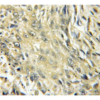 CYP4B1 Rabbit Polyclonal Antibody (11771-1-AP)