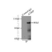 ATRIP Rabbit Polyclonal Antibody (11327-1-AP)