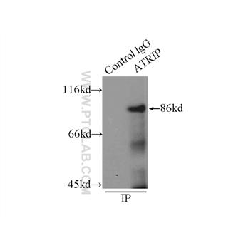 ATRIP Rabbit Polyclonal Antibody (11327-1-AP)