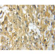 TMOD4 Rabbit Polyclonal Antibody (11753-1-AP)