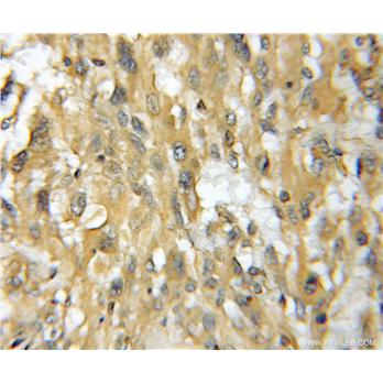 TMOD4 Rabbit Polyclonal Antibody (11753-1-AP)