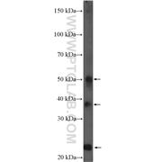 HFE2 Rabbit Polyclonal Antibody (11758-1-AP)