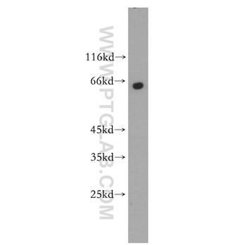 PANK1 Rabbit Polyclonal Antibody (11768-1-AP)
