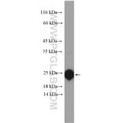 RBP4 Rabbit Polyclonal Antibody (11774-1-AP)
