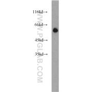 POPDC3 Rabbit Polyclonal Antibody (11800-1-AP)