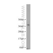 RPP40 Rabbit Polyclonal Antibody (11736-1-AP)