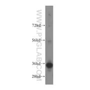 FCN1 Rabbit Polyclonal Antibody (11775-1-AP)
