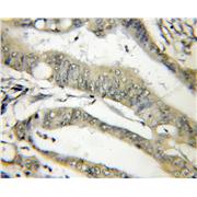THOP1 Rabbit Polyclonal Antibody (11738-1-AP)