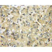 SFTPA1 Rabbit Polyclonal Antibody (11850-1-AP)