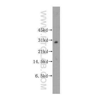 MLF2 Rabbit Polyclonal Antibody (11835-1-AP)