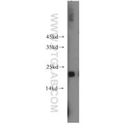 EID1 Rabbit Polyclonal Antibody (11734-1-AP)