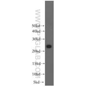 RAB2B Rabbit Polyclonal Antibody (11756-1-AP)