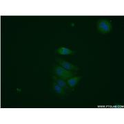 HNMT Rabbit Polyclonal Antibody (11874-1-AP)