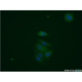 HNMT Rabbit Polyclonal Antibody (11874-1-AP)