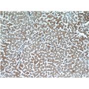 SERPINA10 Rabbit Polyclonal Antibody (11851-1-AP)