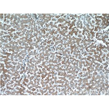 SERPINA10 Rabbit Polyclonal Antibody (11851-1-AP)