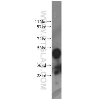 KYNU Rabbit Polyclonal Antibody (11796-1-AP)