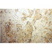 SIRPB1 Rabbit Polyclonal Antibody (11811-1-AP)