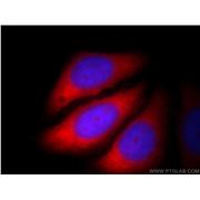 CACYBP Rabbit Polyclonal Antibody (11745-1-AP)