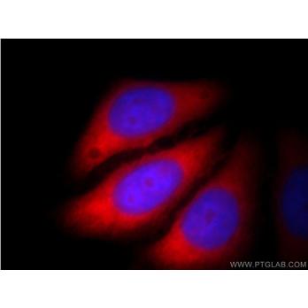 CACYBP Rabbit Polyclonal Antibody (11745-1-AP)