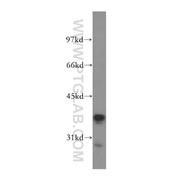 RFC3 Rabbit Polyclonal Antibody (11814-1-AP)