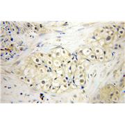 SDCCAG1 Rabbit Polyclonal Antibody (11840-1-AP)