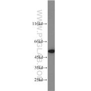 NAMPT Rabbit Polyclonal Antibody (11776-1-AP)