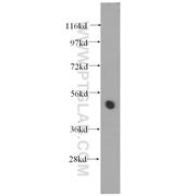 TTC4 Rabbit Polyclonal Antibody (11878-1-AP)