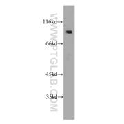 ARPP-21 Rabbit Polyclonal Antibody (11829-1-AP)